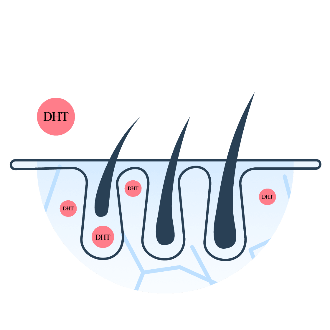 Dutasteride