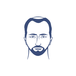 Thinning Crown