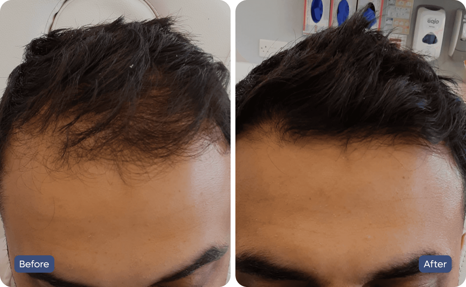 Real result 1